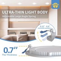 Deruce Lum 12 Pack 4 Inch 5Cct Ultrathin Led Recessed Light, Superbright Recessed Lighting 4 Inches Led Recessed Light For Living Room Bedroom Kitchen Hallway 9W 750Lm- Etl & Energy Star Certified